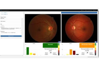 VoxelCloud Retinal Image Management Software