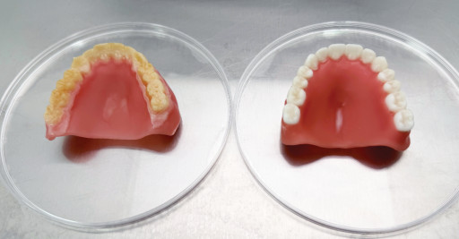 Glidewell Presents Study on Antimicrobial 3D-Printed Dentures at Antibiotics 2026 Conference in Barcelona