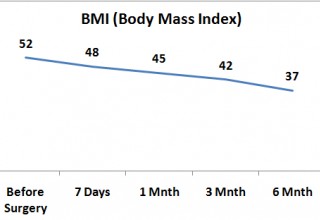 BMI After Weight Loss Surgery
