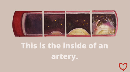 Inside an Artery