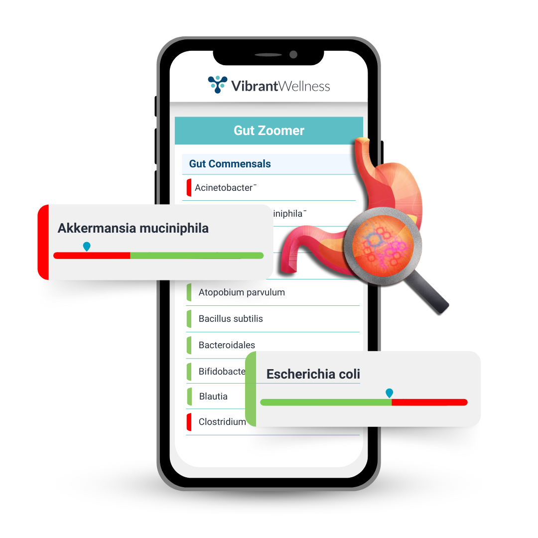 Gut Zoomer Sample Report Mockup