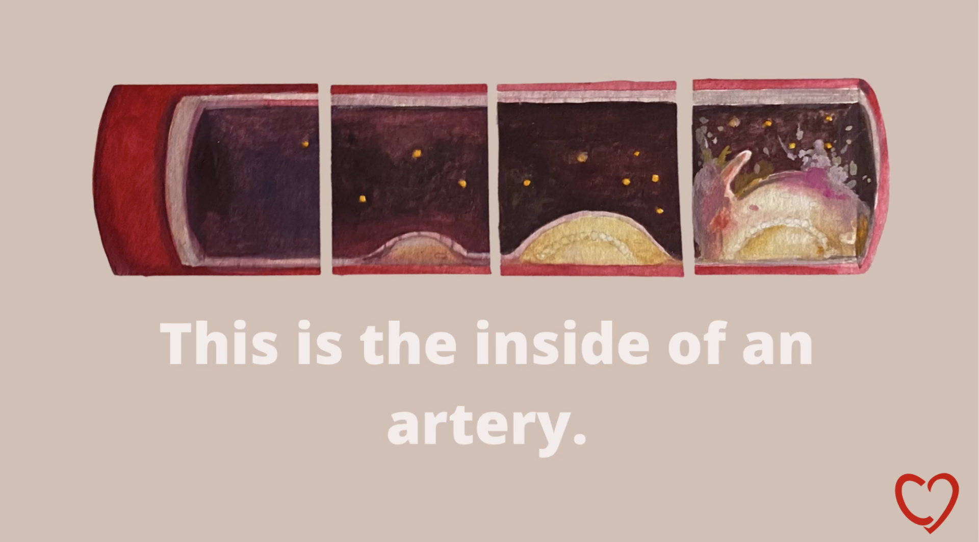 Inside an Artery 