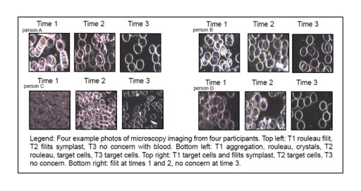 Quantum Healing in Focus: Study Reveals How Scalar Wave Technology Boosts Human Well-Being