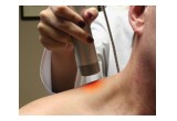 Advanced laser treatments for pain