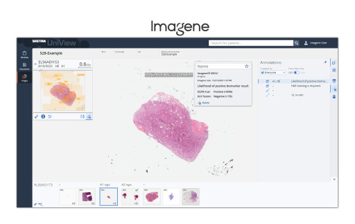 Imagene Increases Accessibility of Rapid AI-Based Biomarker Profiling Through Integration With Sectra