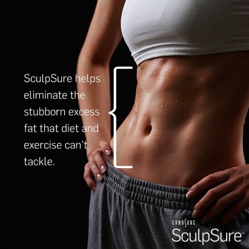 SculpSure™ : The Battle of the Bulge Heats Up at the SHAW Center in Scottsdale