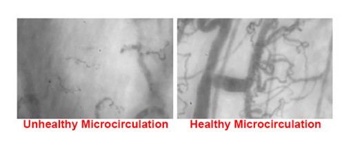 Microvascular Dysfunction in COVID-19 Patients: MYSTIC Study
