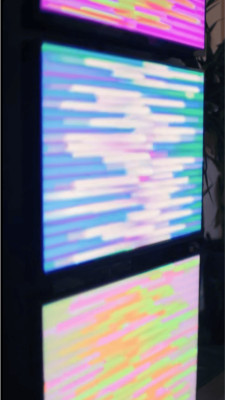 Multiple Sclerosis Patient Finds Hope in Scalar Energy Healing Technology