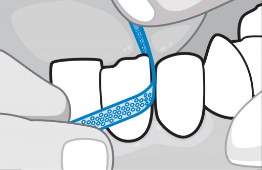 The Sacramento Dentistry Group Explains How IPR Makes Invisalign More Effective