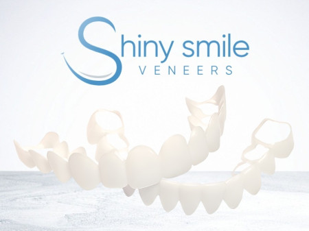 Shiny Smile Veneers Review: Custom Snap-On Veneers