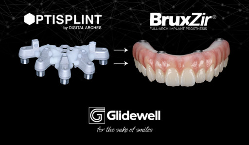 Glidewell Partners With Digital Arches to Streamline All-on-X Workflows