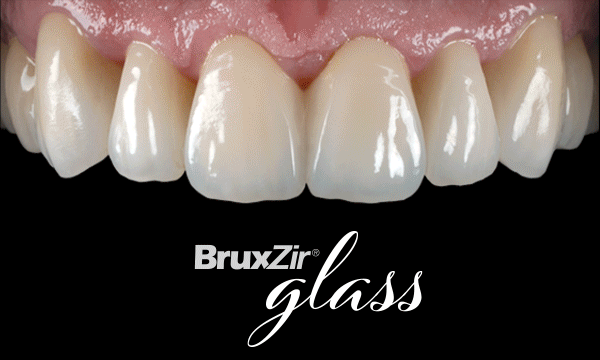 Glidewell Launches BruxZir® Glass Restorations