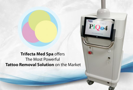 Another Giant Leap Into Beauty Introduced by Trifecta Med Spa- New Tattoo Laser Removal Innovation
