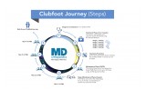 Clubfoot Journey