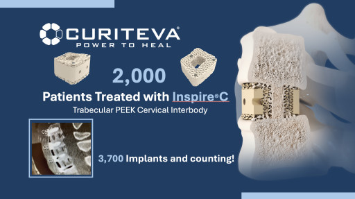 Curiteva Surpasses 2,000 Procedures With Inspire(R)C Cervical Trabecular PEEK(TM) With HAFUSE(R) Technology