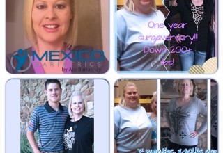 Bariatric surgery patient in Mexico offering her testimonial about her weight loss surgery at Mexico Bariatrics.