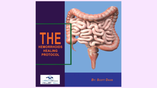 Hemorrhoids Healing Protocol: Review of a 3-Week Lifestyle-Based Approach to Dietary and Movement Factors