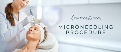 Who Does the Best Microneedling in Bellevue and Kirkland, WA?