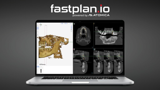 Glidewell Introduces fastplan.io(TM) Software for In-Office Guided Implant Planning and Surgical Design