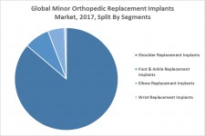 Global Minor Orthopedic Replacement Implants Market, 2017, Split By Segments
