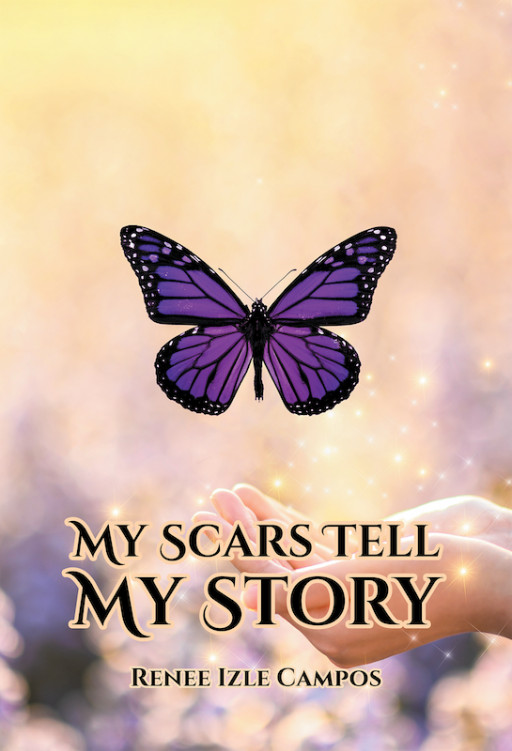 Author Renee Izle Campos's New Book, 'My Scars Tell My Story', is a Powerful Memoir Detailing How the Author's Faith Helped Her Through Years of Abuse