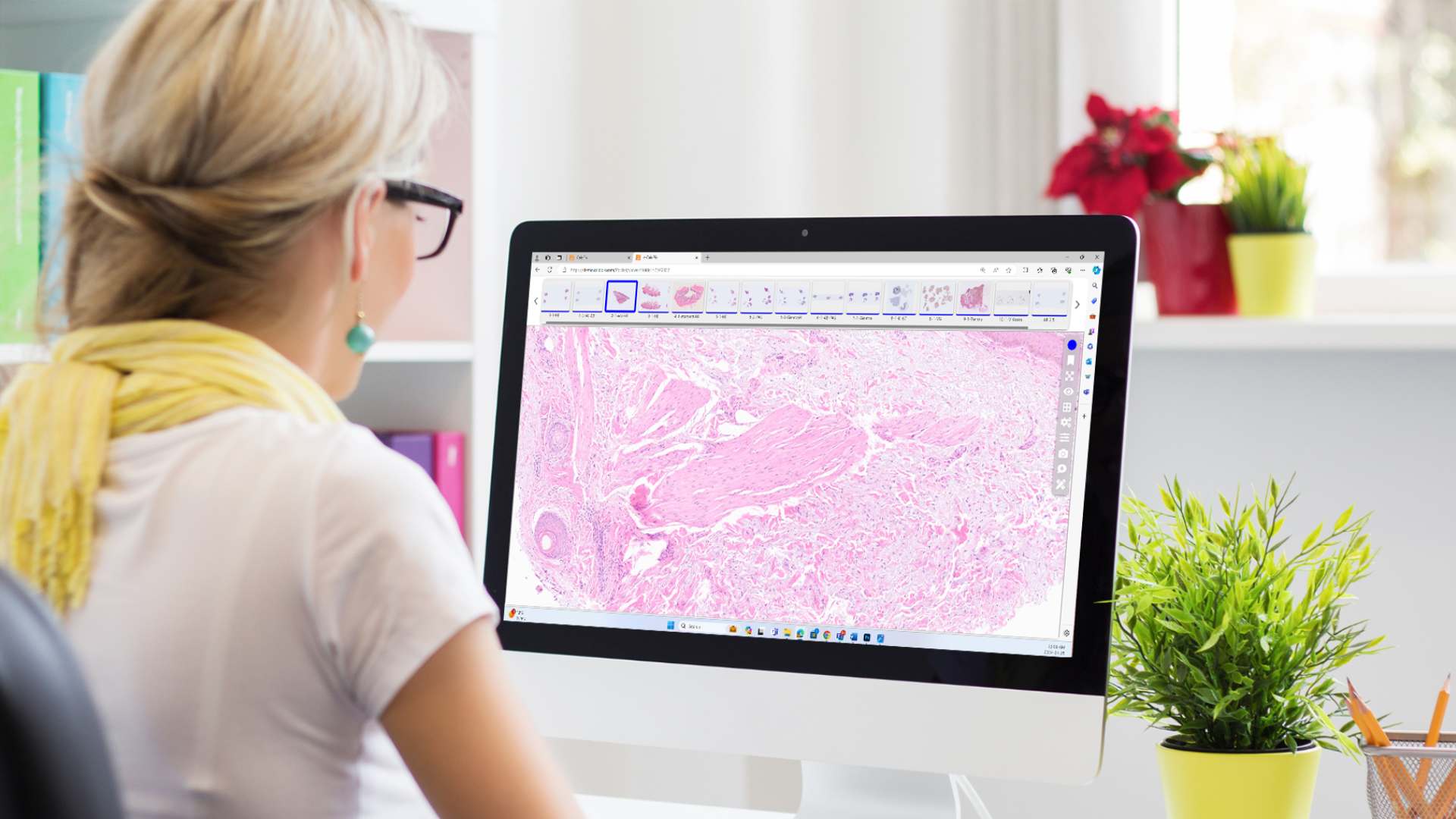 Pathologist using CaloPix® for Digital Slide Review 