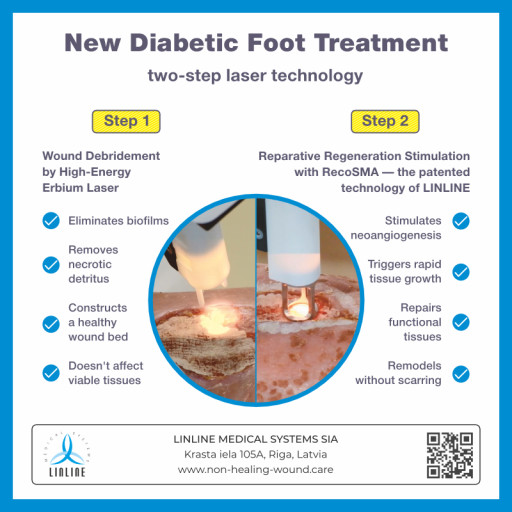 Groundbreaking Study Reveals the Effectiveness of New RecoSMA Laser Treatment for Diabetic Foot