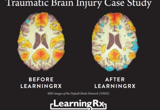 Brain Injury Research with LearningRx Brain Training