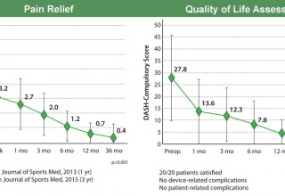 Pain Relief and Quality of Life post-procedure charts (Tenex Health TX)