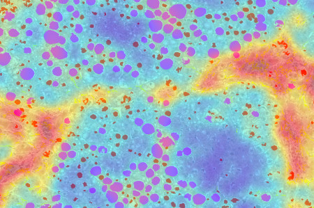 FIbroNest Analysis of a Liver Biopsy