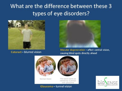 Eye Diseases - Macular Degeneration, Cataract and Glaucoma