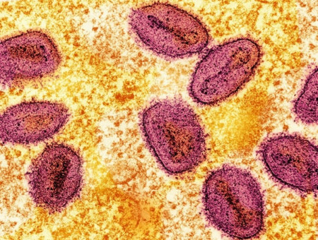 Mpox Virus