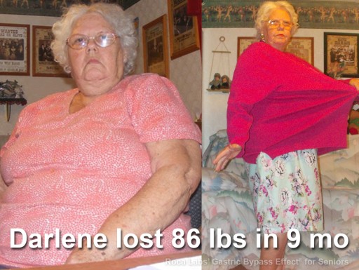 Roca Labs' Gastric Bypass Effect Helps Seniors Gain Health; Darlene, 75, Successfully Dropped 86 lbs