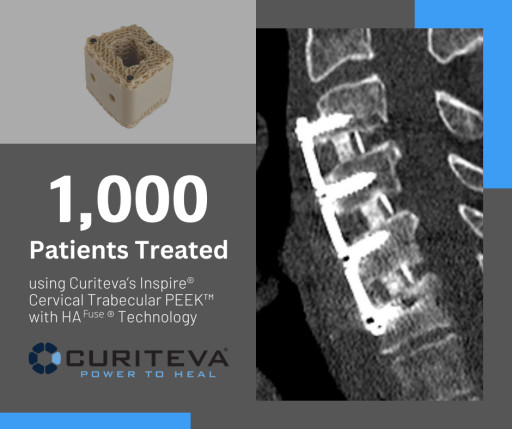 Curiteva Surpasses 1,000 Procedures With Inspire® Cervical Trabecular PEEK™ With HAFUSE® Technology