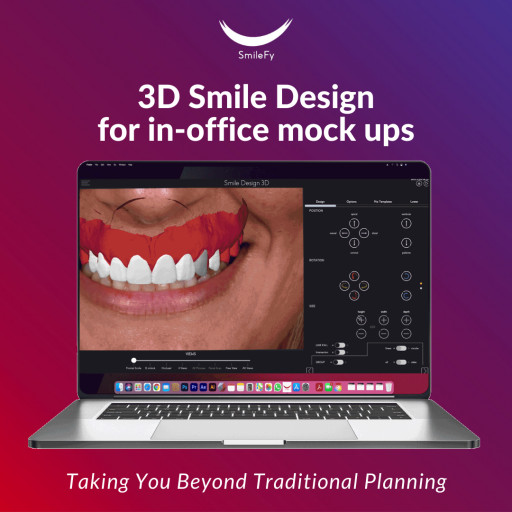 SmileFy Releases 3D Smile Design for Facially Guided In-Office Digital Treatment Planning
