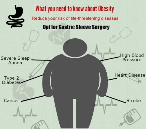 Bariatric Surgery World Offers All-Inclusive Packages for Obesity Surgery in Mexican Border Areas