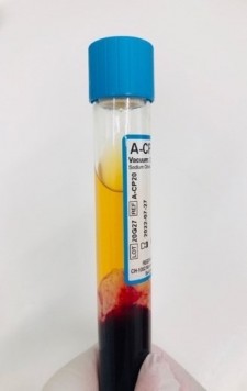 Acellular-Convalescent Plasma Tube (A-CP)