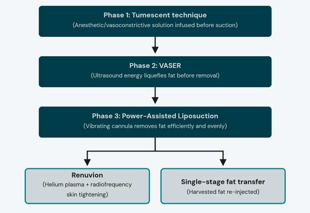 Figure 1. Dr. Sajan's layered liposuction and body-contouring process.