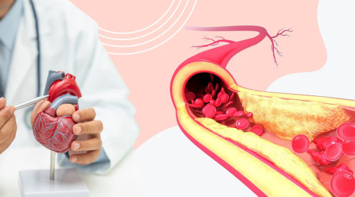 The Holy Grail of Cardiology Has Arrived