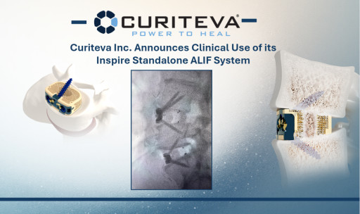 Curiteva Announces First Clinical Use of Inspire Standalone ALIF System
